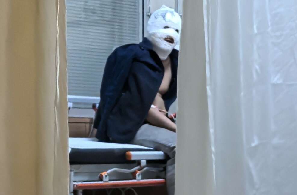 Benzinle sobayı tutuşturmaya çalışan