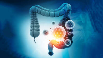 Kolon kanseri en sık görülen 3 kanser arasında yer alıyor