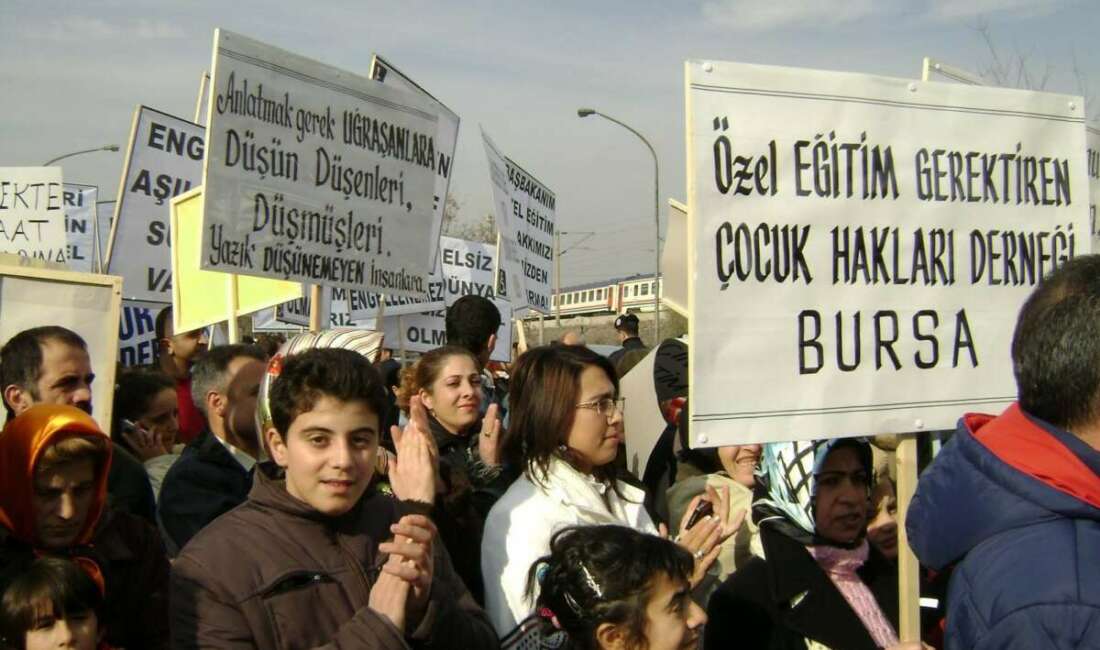Ankara’da down sendromlu çocuğu