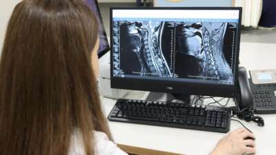  MS hastalığında erken teşhis hayat kalitesini arttırıyor