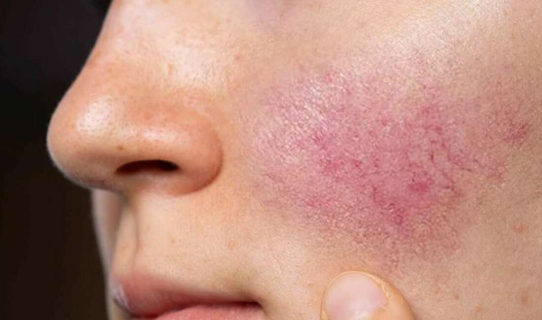 Hayat Hastanesi Dermatoloji Uzmanı