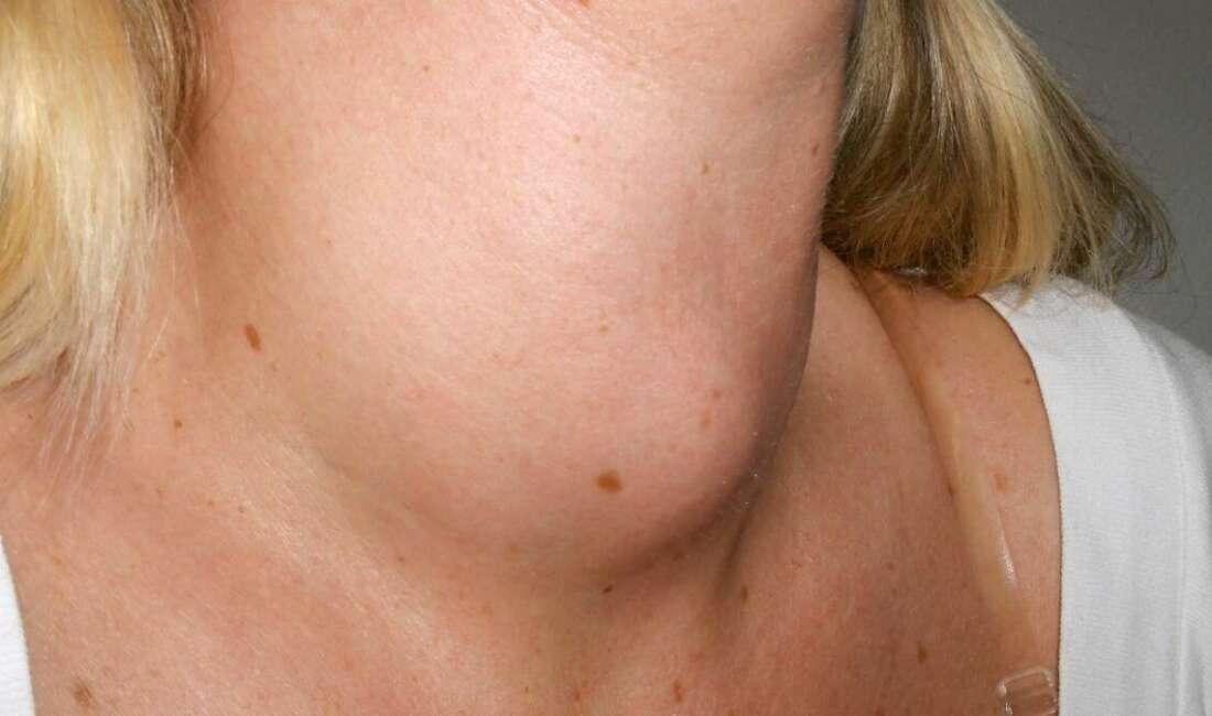 Toplumda yaygın olarak görülen