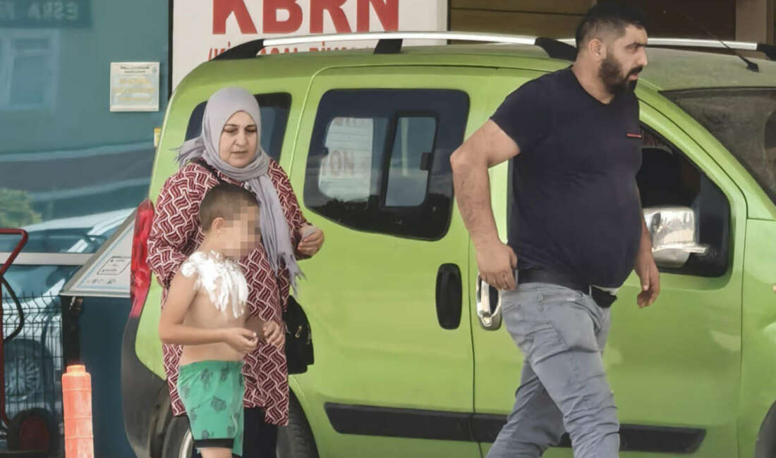 Üzerine parfüm sıkıp çakmak yakan çocuk yaralandı Bursa'nın İnegöl ilçesinde meydana