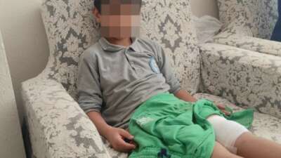 Okula giderken sokak köpeğinin saldırısına uğradı