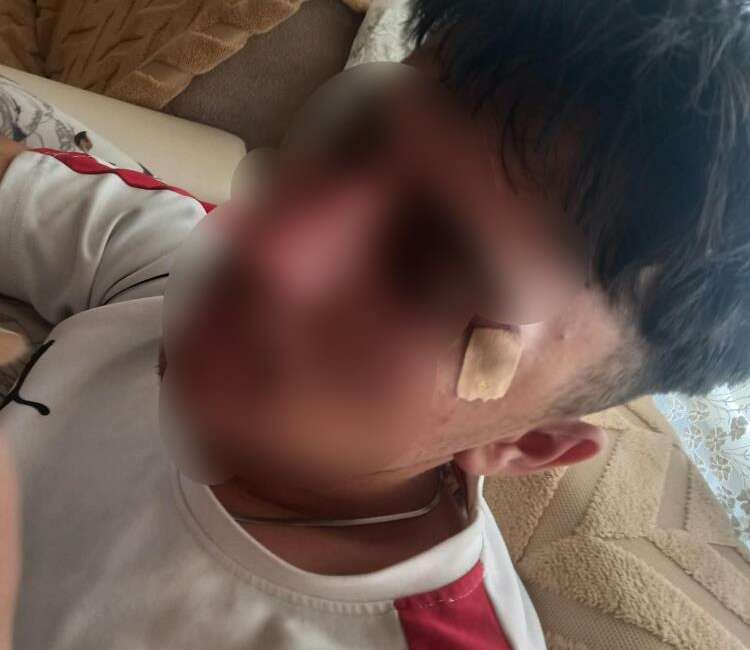 Öğretmenin yaptığına bakın; Öğrencisinin burnunu kırdı… Afyonkarahisar'da çıraklık eğitim merkezinde